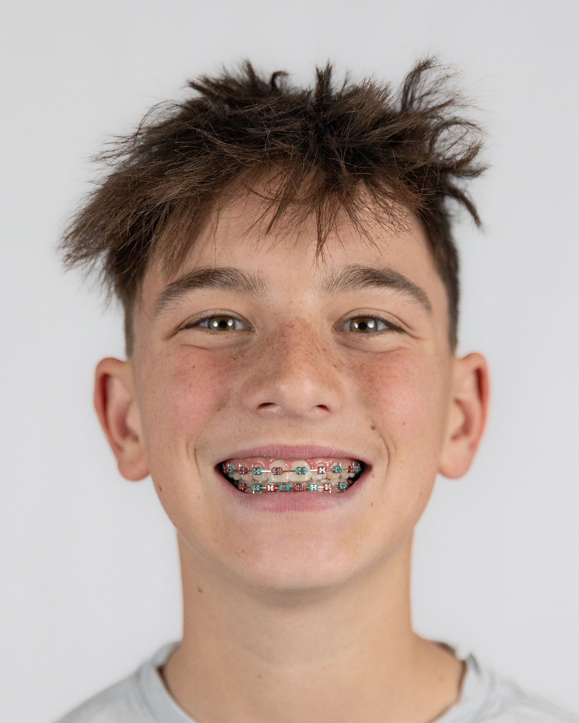 Summitview Pediatric Dentistry
