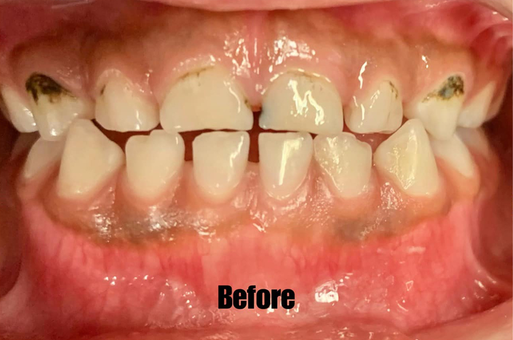 Summitview Pediatric Dentistry