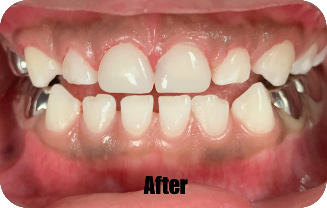 Summitview Pediatric Dentistry